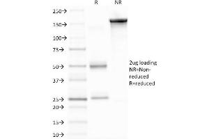 SDS-PAGE (SDS) image for anti-Matrix Metallopeptidase 9 (Gelatinase B, 92kDa Gelatinase, 92kDa Type IV Collagenase) (MMP9) (AA 603-614) antibody (ABIN6940074)