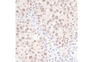 Immunohistochemistry (IHC) image for anti-DEAH (Asp-Glu-Ala-His) Box Polypeptide 8 (DHX8) (AA 325-375) antibody (ABIN7454652)