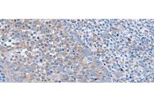 Immunohistochemistry of paraffin-embedded Human tonsil tissue using ZIC1 Polyclonal Antibody at dilution of 1:65(x200) (ZIC1 Antikörper)