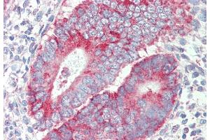 ABIN987282 (5 μg/mL) staining of paraffin embedded Human Uterus. (P2RX4 Antikörper  (Internal Region))