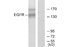 Western blot analysis of extracts from HT-29 cells, using EGFR (Ab-1172) antibody.
