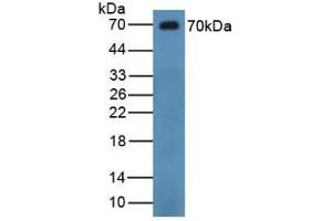 Detection of CHGB in Human Serum using Polyclonal Antibody to Chromogranin B (CHGB) (CHGB Antikörper  (AA 496-669))