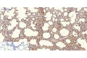 Immunohistochemistry of paraffin-embedded Rat lung tissue using NBR1 Monoclonal Antibody at dilution of 1:200. (NBR1 Antikörper)