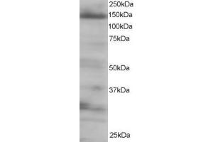 Western Blotting (WB) image for anti-Eukaryotic Translation Initiation Factor 4E Nuclear Import Factor 1 (EIF4ENIF1) (C-Term) antibody (ABIN2465331) (EIF4ENIF1 Antikörper  (C-Term))