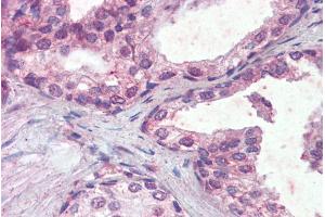ABIN335143 (5µg/ml) staining of paraffin embedded Human Prostate. (IFNAR2 Antikörper  (Internal Region))