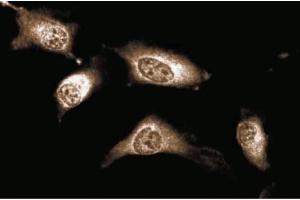 Immunofluorescent staining of Human Endothelial cells. (JAK1 Antikörper  (AA 551-766))