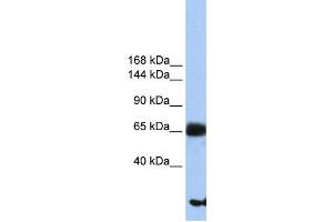 Western Blotting (WB) image for anti-Phosphatidylinositol Glycan Anchor Biosynthesis, Class O (PIGO) antibody (ABIN2459357) (PIGO Antikörper)
