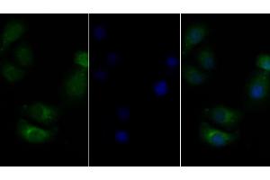 Detection of CSF2Rb in Human Hela cell using Polyclonal Antibody to Colony Stimulating Factor 2 Receptor Beta (CSF2Rb) (CD131 Antikörper  (AA 133-233))