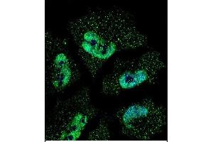 Confocal immunofluorescent analysis of ELAVL1 Antibody (ABIN659118 and ABIN2843759) with NCI- cell followed by Alexa Fluor® 488-conjugated goat anti-mouse lgG (green).