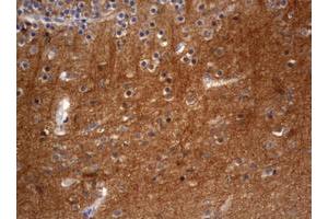 Image no. 1 for anti-Visinin-Like 1 (VSNL1) (AA 2-191) antibody (ABIN1491124)