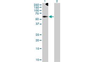 Western Blot analysis of TRIM9 expression in transfected 293T cell line by TRIM9 MaxPab polyclonal antibody.