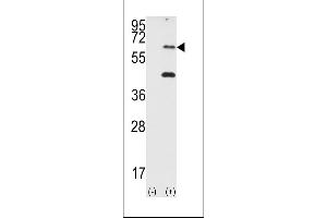 Western blot analysis of EIF2AK2 (arrow) using PRKR Antibody (N-term) (ABIN392778 and ABIN2837994).