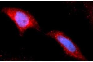 Immunofluorescence (IF) image for anti-Hexokinase 2 (HK2) (AA 1-917) antibody (APC) (ABIN5565592) (Hexokinase 2 Antikörper  (AA 1-917) (APC))