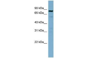 WB Suggested Anti-STAT3 Antibody Titration: 0. (STAT3 Antikörper  (Middle Region))
