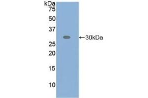 Detection of Recombinant ATF6, Human using Polyclonal Antibody to Activating Transcription Factor 6 (ATF6) (ATF6 Antikörper  (AA 423-646))