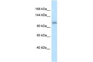 WB Suggested Anti-Zfr Antibody Titration: 1. (ZFR Antikörper  (N-Term))