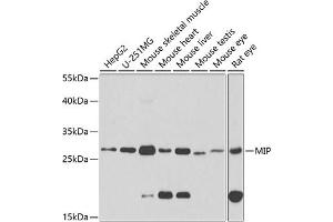 Western blot analysis of extracts of various cell lines, using MIP antibody (ABIN3016917, ABIN3016918, ABIN3016919 and ABIN6219879) at 1:1000 dilution. (Mip (AA 50-150) Antikörper)