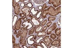 Immunohistochemical staining of human kidney with NDUFC1 polyclonal antibody  shows strong cytoplasmic positivity in cells in tubules. (NDUFC1 Antikörper)