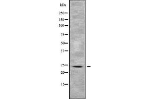 Western blot analysis of RAB5B using COLO205 whole cell lysates (RAB5B Antikörper  (C-Term))