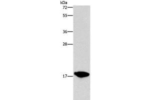 Western Blot analysis of HepG2 cell using CCL16 Polyclonal Antibody at dilution of 1:760 (CCL16 Antikörper)
