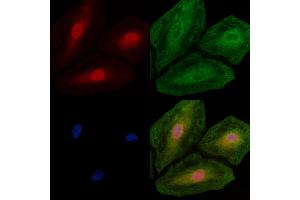 ABIN7094705 and ABIN7098756 staining  cells by IF/ICC.