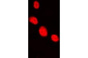 Immunofluorescent analysis of LHX1 staining in HepG2 cells.