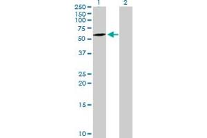 Western Blot analysis of ATG16L1 expression in transfected 293T cell line by ATG16L1 MaxPab polyclonal antibody. (ATG16L1 Antikörper  (AA 1-523))