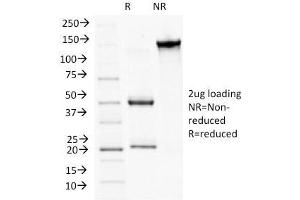 SDS-PAGE Analysis Purified CD56 Monoclonal Antibody (NCAM1/784). (Plakophilin 1 Antikörper  (N-Term))