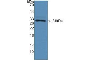 Detection of Recombinant F13A1, Human using Polyclonal Antibody to Coagulation Factor XIII A1 Polypeptide (F13A1) (F13A1 Antikörper  (AA 107-345))