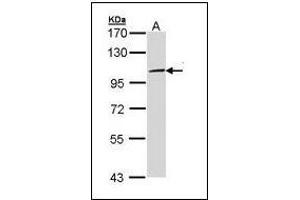 Sample (30 µg of whole cell lysate). (TLR3 Antikörper)