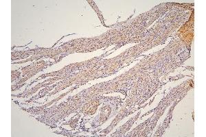 IHC analysis of PHF21A using anti-PHF21A antibody (ABIN6719353).