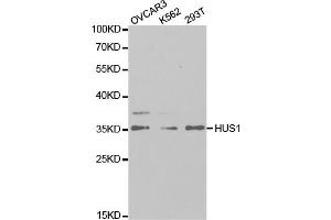 Western blot analysis of extracts of various cell lines, using HUS1 antibody (ABIN5973136) at 1/1000 dilution. (HUS1 Antikörper)