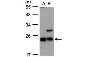 WB Image Sample(30 ug whole cell lysate) A:293T B:Raji , 12% SDS PAGE antibody diluted at 1:1000 (CBFB Antikörper)