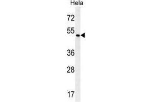 ZMYND17 Antibody (C-term) western blot analysis in Hela cell line lysates (35 µg/lane). (ZMYND17 Antikörper  (C-Term))