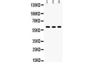 Western Blotting (WB) image for anti-V-Yes-1 Yamaguchi Sarcoma Viral Oncogene Homolog 1 (YES1) (AA 7-35), (N-Term) antibody (ABIN3042333)