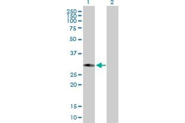 PHYHD1 Antikörper  (AA 1-297)