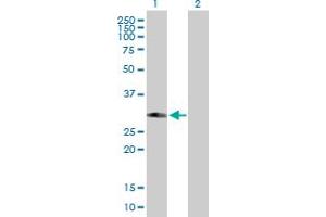 Western Blot analysis of PHYHD1 expression in transfected 293T cell line by PHYHD1 MaxPab polyclonal antibody. (PHYHD1 Antikörper  (AA 1-297))