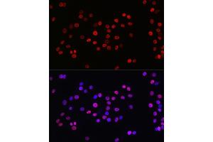 Immunofluorescence analysis of PC-12 cells using Acetyl-Histone H3-K27 Rabbit mAb (ABIN3016650, ABIN3016651, ABIN3016652, ABIN1682513 and ABIN1682514) at dilution of 1:100 (40x lens). (Histone 3 Antikörper  (acLys27))