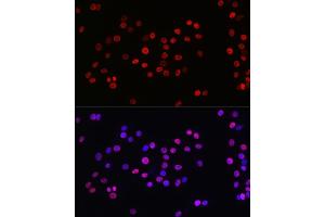 Immunofluorescence analysis of PC-12 cells using Acetyl-Histone H3-K27 Rabbit mAb (ABIN3016650, ABIN3016651, ABIN3016652, ABIN1682513 and ABIN1682514) at dilution of 1:100 (40x lens). (Histone H3 (Acetyl K27) (acLys27) Antikörper)
