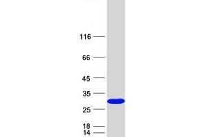 Validation with Western Blot (SSSCA1 Protein (Myc-DYKDDDDK Tag))
