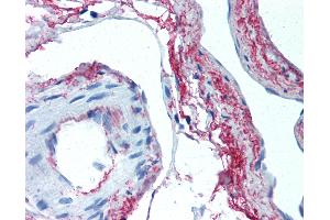 Anti-Elastin antibody IHC of human skeletal muscle, vessels.