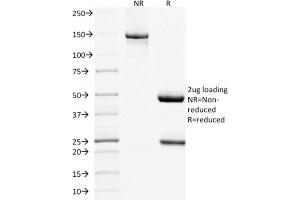 SDS-PAGE (SDS) image for anti-Tumor Necrosis Factor Receptor Superfamily, Member 13C (TNFRSF13C) antibody (ABIN6939146)