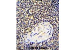 Immunohistochemistry (IHC) image for anti-ArfGAP with Coiled-Coil, Ankyrin Repeat and PH Domains 1 (ACAP1) antibody (ABIN2996040) (ACAP1 Antikörper)