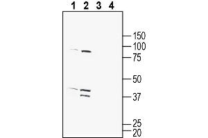 Western blot analysis of mouse brain membranes (lanes 1 and 3) and rat brain membranes (lanes 2 and 4):1-2.