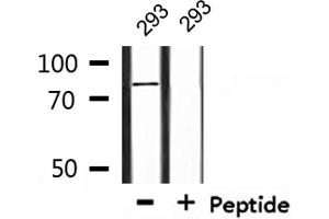 Western blot analysis of extracts from 293, using TGM2 Antibody. (Transglutaminase 2 Antikörper  (N-Term))