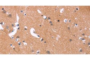 Immunohistochemistry of paraffin-embedded Human brain using MAPK11 Polyclonal Antibody at dilution of 1:30 (MAPK11 Antikörper)