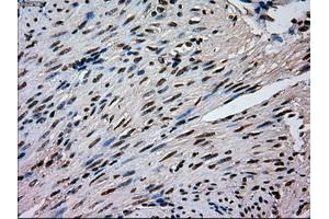 Immunohistochemical staining of paraffin-embedded pancreas tissue using anti-MAPK1mouse monoclonal antibody. (ERK2 Antikörper)