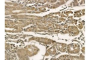 KLHL4 Mouse Monoclonal Antibody at 1/100 staining human normal gastric tissue by IHC-P. (Kelch-Like 4 Antikörper)