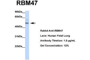 Host: Rabbit  Target Name: RBM47  Sample Tissue: Human Fetal Lung  Antibody Dilution: 1. (RBM47 Antikörper  (Middle Region))