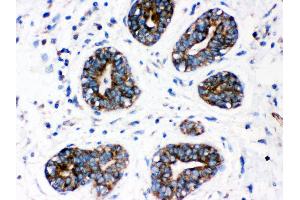 Immunohistochemistry (IHC) image for anti-Cytochrome P450, Family 1, Subfamily A, Polypeptide 1 (CYP1A1) (AA 183-320) antibody (ABIN3043819)